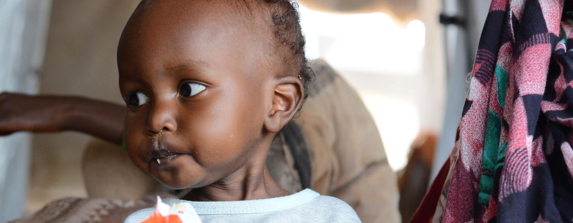 Malnutrition in Zamzam