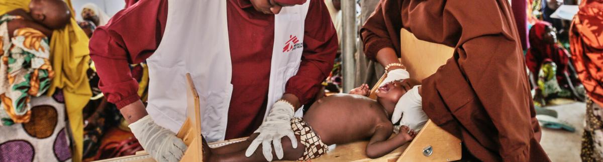 Nutritional crisis in northwest Nigeria