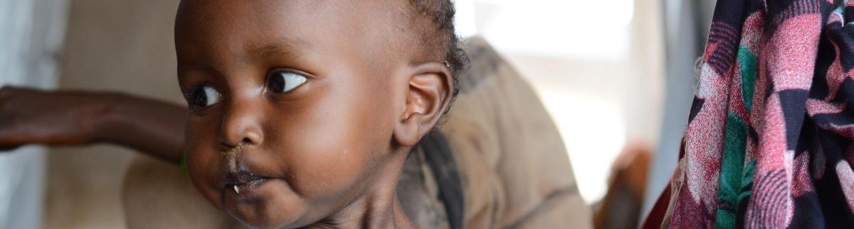 Malnutrition in Zamzam