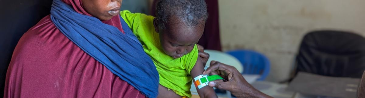Emergencia de desnutrición en Mudug, Somalia.