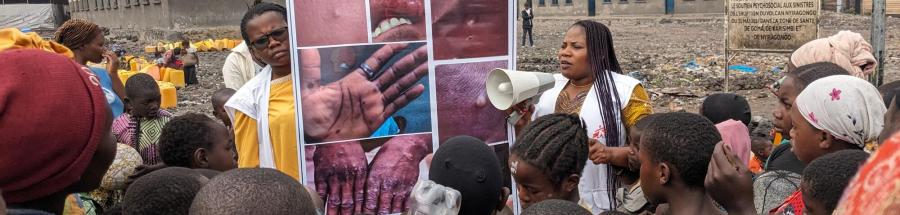Mpox en RDC