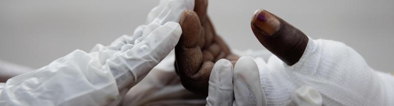 El viaje de una mujer herida en el hospital SICA de MSF en Bangui