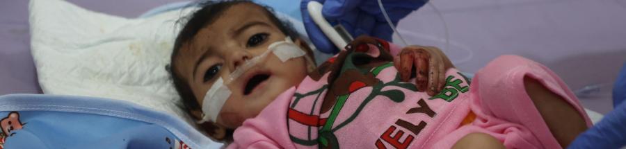 Niño ingresado en el Centro de Alimentación Terapéutica del Hospital General de Abs, que cuenta con el apoyo de MSF. Se le diagnosticó desnutrición aguda grave y actualmente está recibiendo tratamiento.