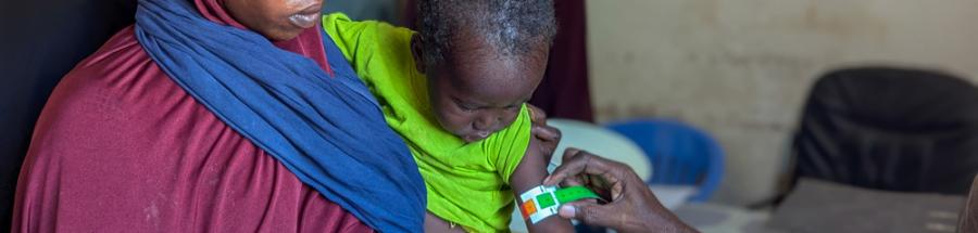 Emergencia de desnutrición en Mudug, Somalia.