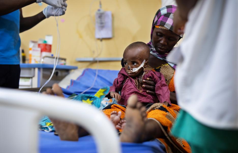 Paciente con desnutrición y noma. Kano, Nigeria.