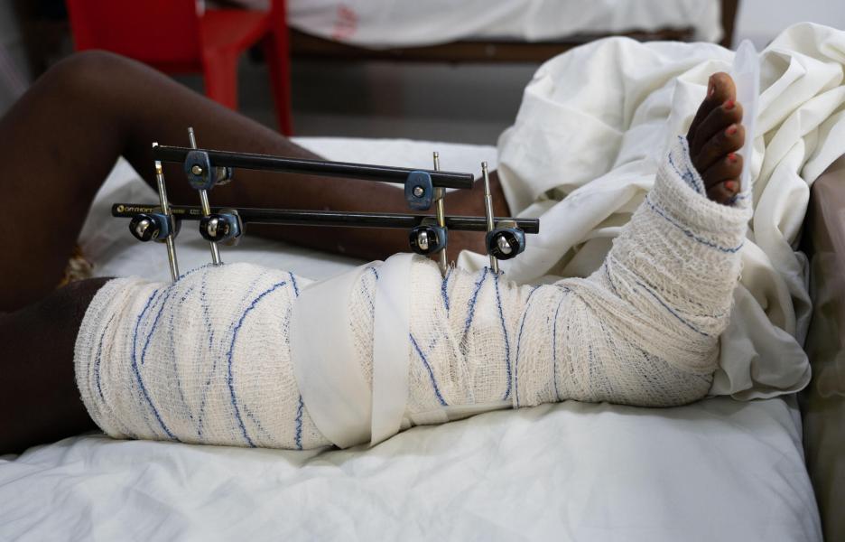 Mujer hospitalizada en el hospital de MSF en Tabarre, Puerto Príncipe