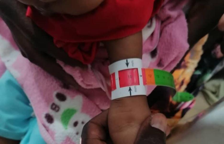 Centro de alimentación terapéutica de MSF en el campo de Zamzam, Sudán.