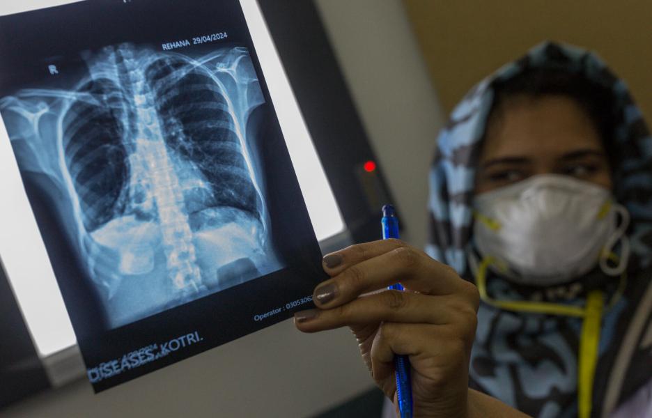 La doctora Muneeba Shaikh examina los resultados de la radiografía de Rehana, una paciente de tuberculosis, en Kotri, Pakistán.