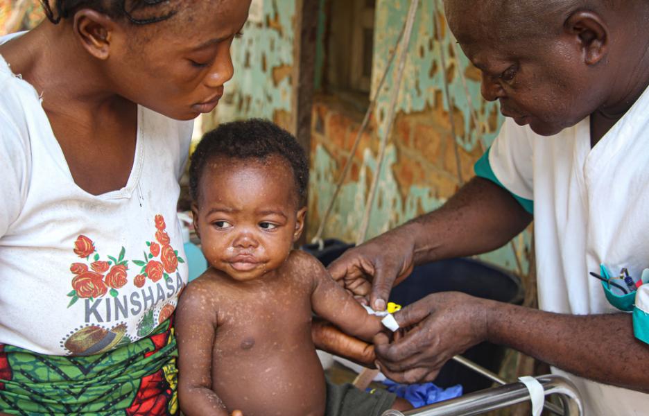 Epidemia de sarampión en Kampene