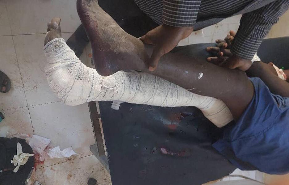 Un paciente del Hospital Universitario Nyala, que apoyamos, tras los ataques aéreos del 3 de febrero de 2025. MSF