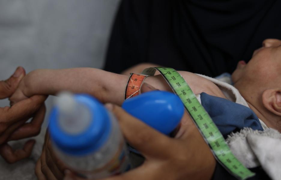 Starvation and Survival: Malnutrition in Gaza