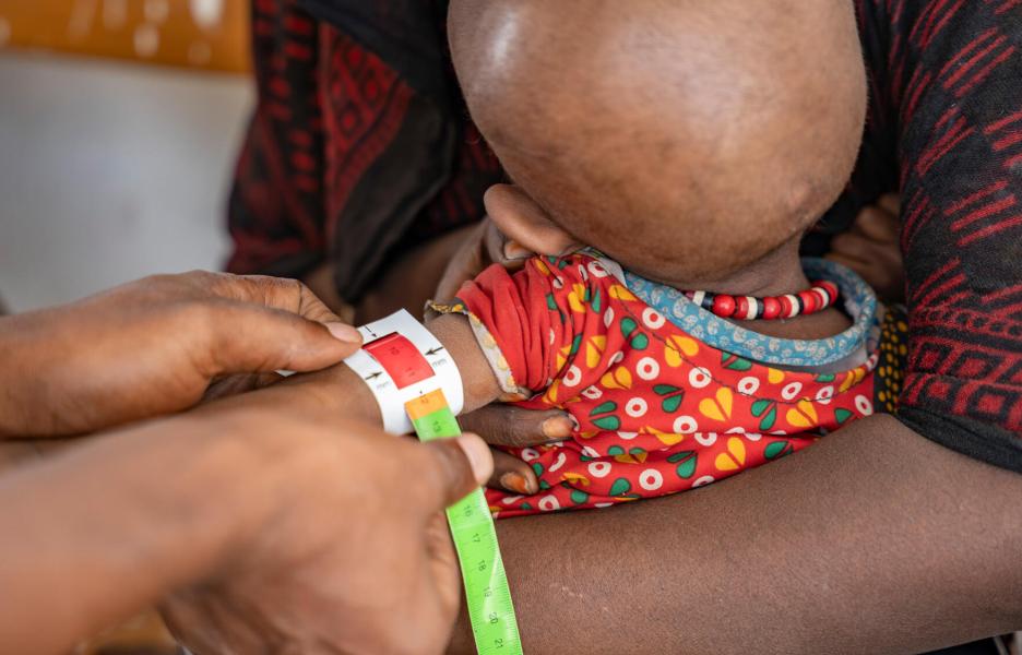 Equipo de MSF usa un MUAC para medir el perímetro braquial de un niño en el centro de salud. Afar, Etiopía.