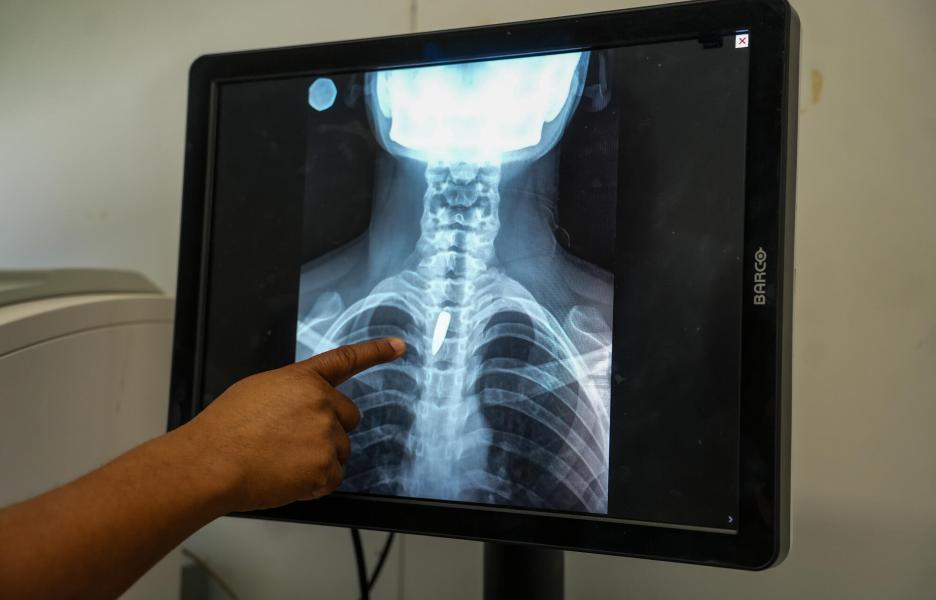Haití: cuando llegar a un hospital resulta imposible