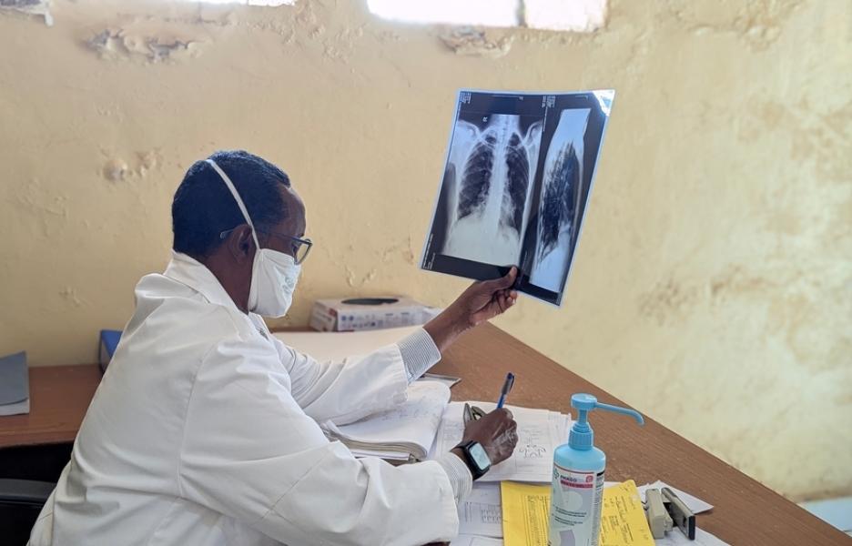 TB e inseguridad alimentaria en Mudug, Somalia