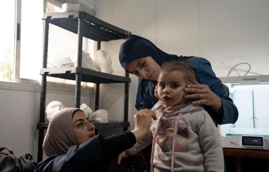 Máscaras 3D para quemaduras en Gaza