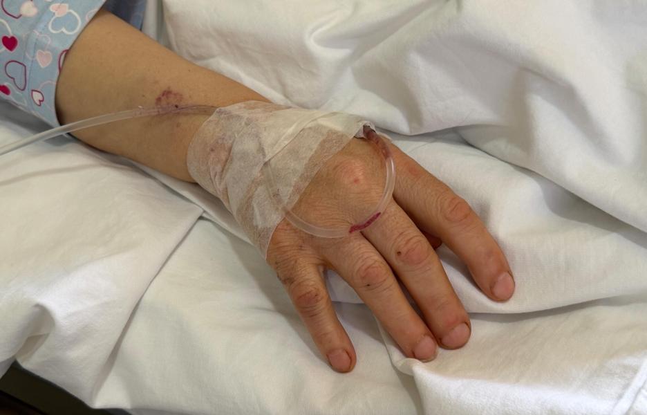 Mano de la enfermera herida por el ataque israelí al hospital Jabal Amel, el 1 de junio.