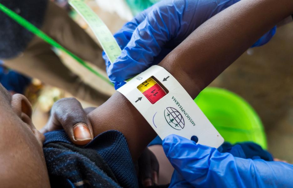 Una enfermera mide la circunferencia de la parte media del brazo de un niño en un centro de salud en Baidoa.