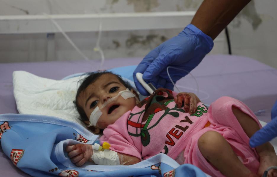 Niño ingresado en el Centro de Alimentación Terapéutica del Hospital General de Abs, que cuenta con el apoyo de MSF. Se le diagnosticó desnutrición aguda grave y actualmente está recibiendo tratamiento.
