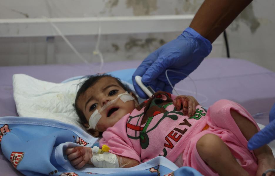 Niño ingresado en el Centro de Alimentación Terapéutica del Hospital General de Abs, que cuenta con el apoyo de MSF. Se le diagnosticó desnutrición aguda grave y actualmente está recibiendo tratamiento.