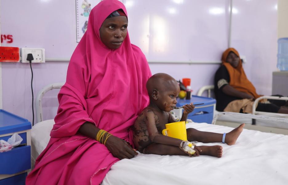 Centro de alimentación terapéutica en Katsina, Nigeria.