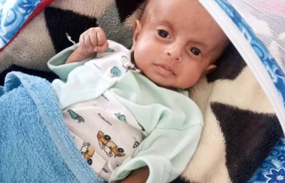 Abdulmalik, un bebé de cuatro meses del distrito de Al-Abdiah, en la provincia de Marib, abandona el Centro de Alimentación Terapéutica Intensiva tras completar su tratamiento.