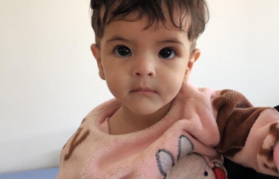 Pequeño paciente del Centro de Alimentación Terapéutica Intensiva tras su recuperación en el Hospital de Rada'a.