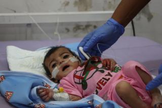 Niño ingresado en el Centro de Alimentación Terapéutica del Hospital General de Abs, que cuenta con el apoyo de MSF. Se le diagnosticó desnutrición aguda grave y actualmente está recibiendo tratamiento.