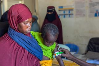 Emergencia de desnutrición en Mudug, Somalia.