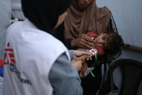 Una trabajadora de MSF atiende a un niño con desnutrición severa, el pasado agosto en Gaza. NOUR ALSAQQA