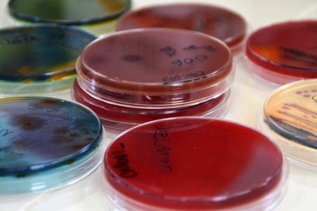Departamento de bacteriología del laboratorio del hospital de Koutiala, Mali.