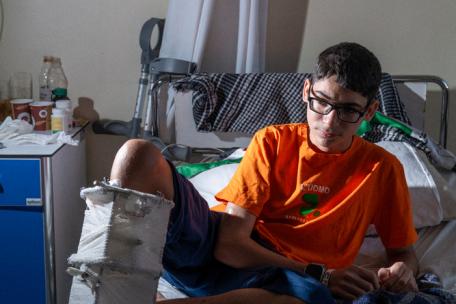 Pacientes gazatíes en el hospital de MSF en Amán
