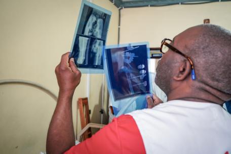 Un médico examina las radiografías de una joven víctima de la violencia armada. Clínica Salama, Bunia, República Democrática del Congo.