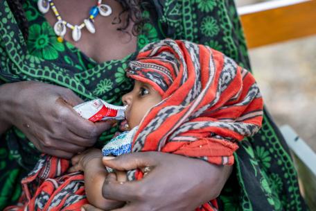 Igahale, de 13 meses, come un sobre de alimento terapéutico