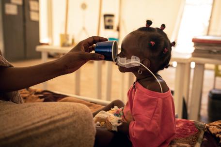 Niña ingresada por desnutrición en Adré, Chad.