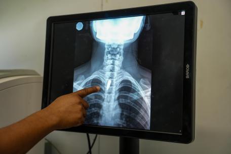 Haití: cuando llegar a un hospital resulta imposible