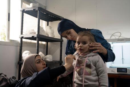 Máscaras 3D para quemaduras en Gaza