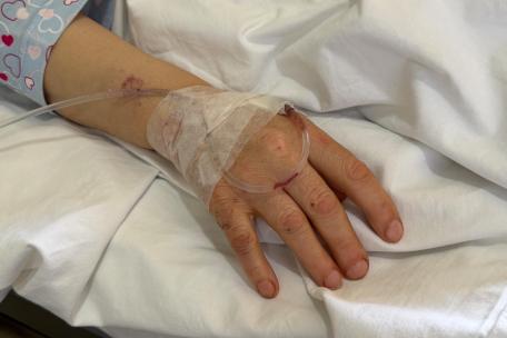 Mano de la enfermera herida por el ataque israelí al hospital Jabal Amel, el 1 de junio.