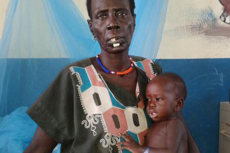 La pequeña Nyuruth Gain Nyandit, de 1 año, junto a su abuela, en nuestro centro de desnutrición terapéutica de Pibor, en Sudán del Sur. 