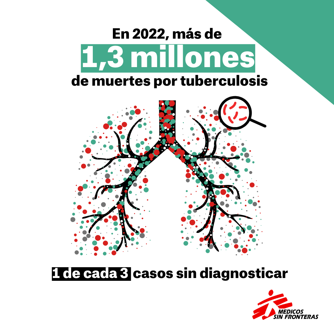 En 2022, más de 1,3 millones de muertes por tuberculosis. 1 de cada 3 casos, sin diagnosticar.