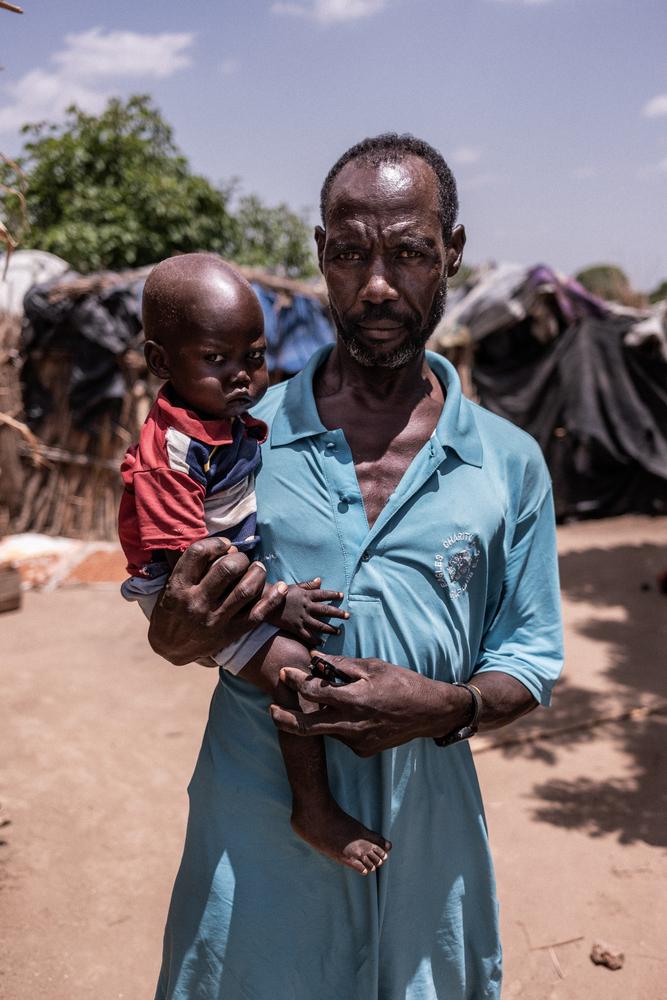 Padre e hijo desnutridos. Campo de personas desplazadas de Hamidiya, Sudán.